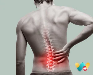 Ankylosing Spondylitis 
