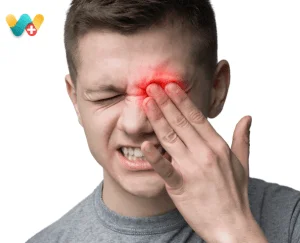 Burning in Eyes