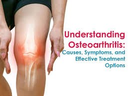 Homoeopathy and Osteoarthritis: a Comprehensive Overview